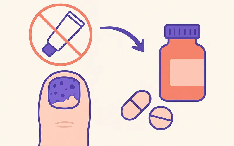 Why Your Topical Nail Fungus Treatment Stopped Working